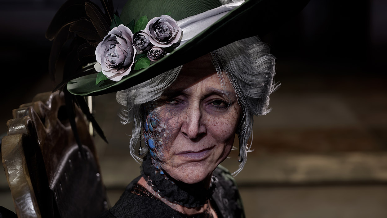 A woman with grey hair and a green hat has blue growths on the left side of her face.